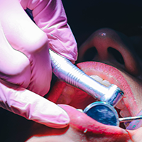 Evita las caries con estos tips